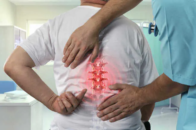 Tuberculosis of Spine